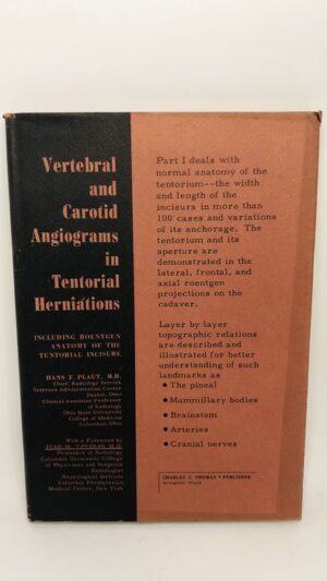 Vertebral and Carotid Angiograms in Tentorial Herniations